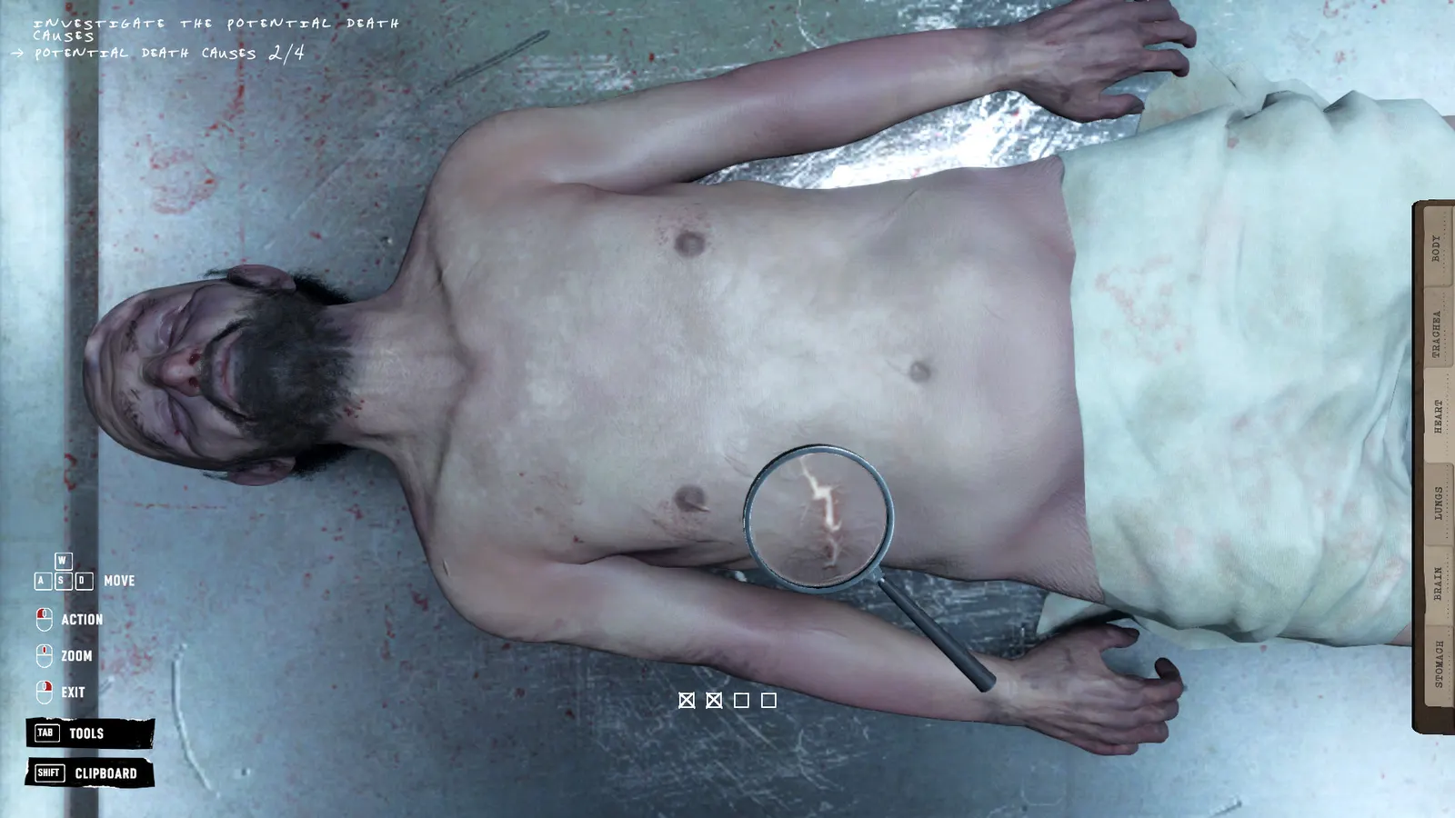 Autopsy Simulator media 10