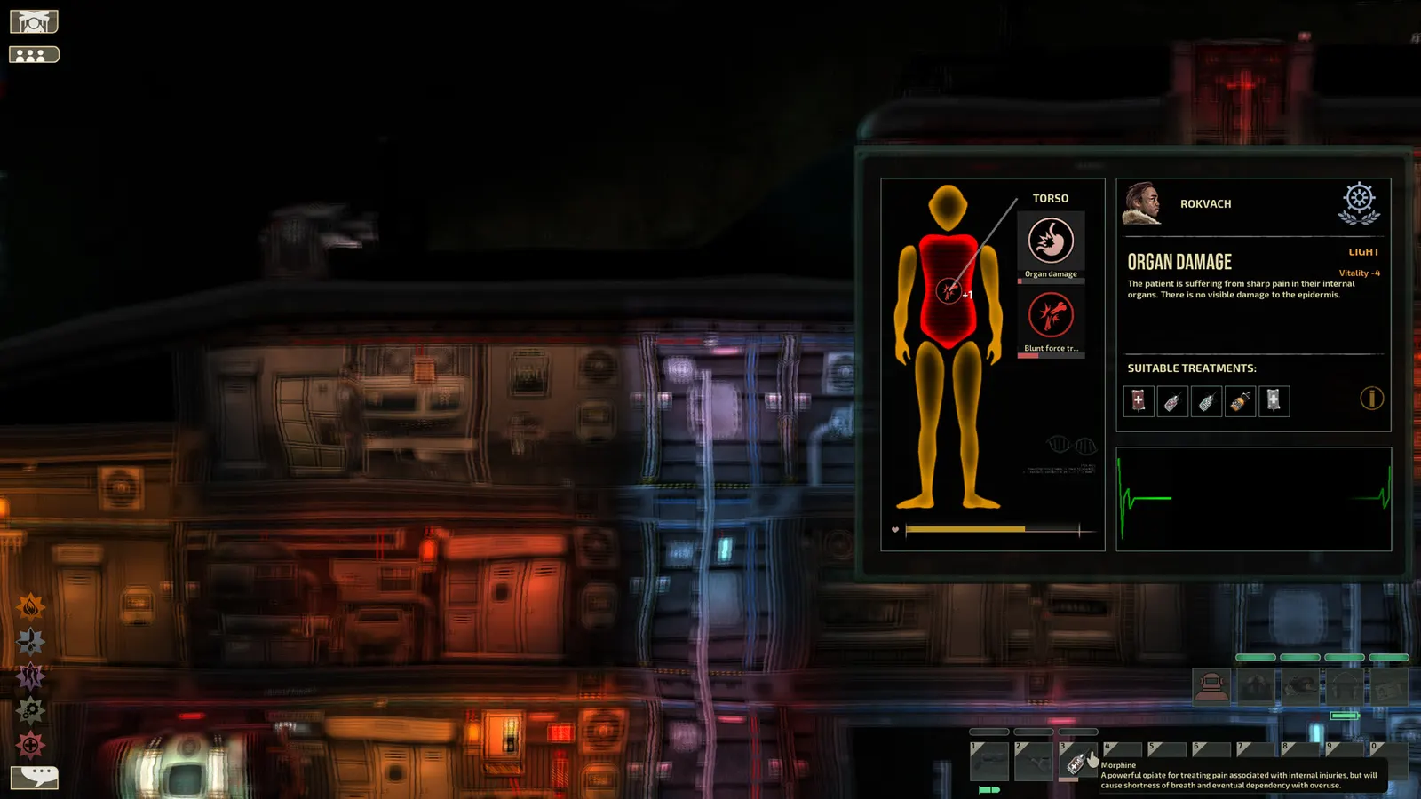 Barotrauma media 10