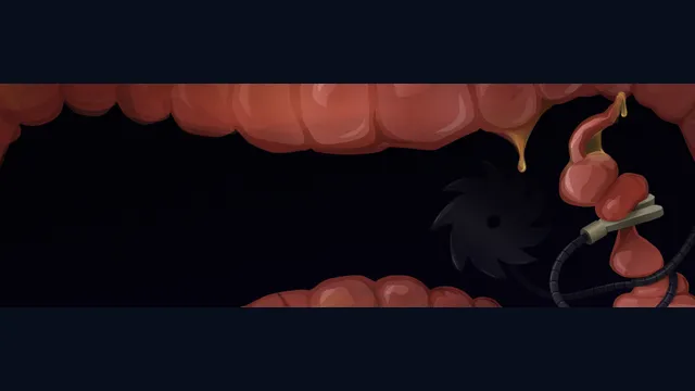 Revenge Of The Colon