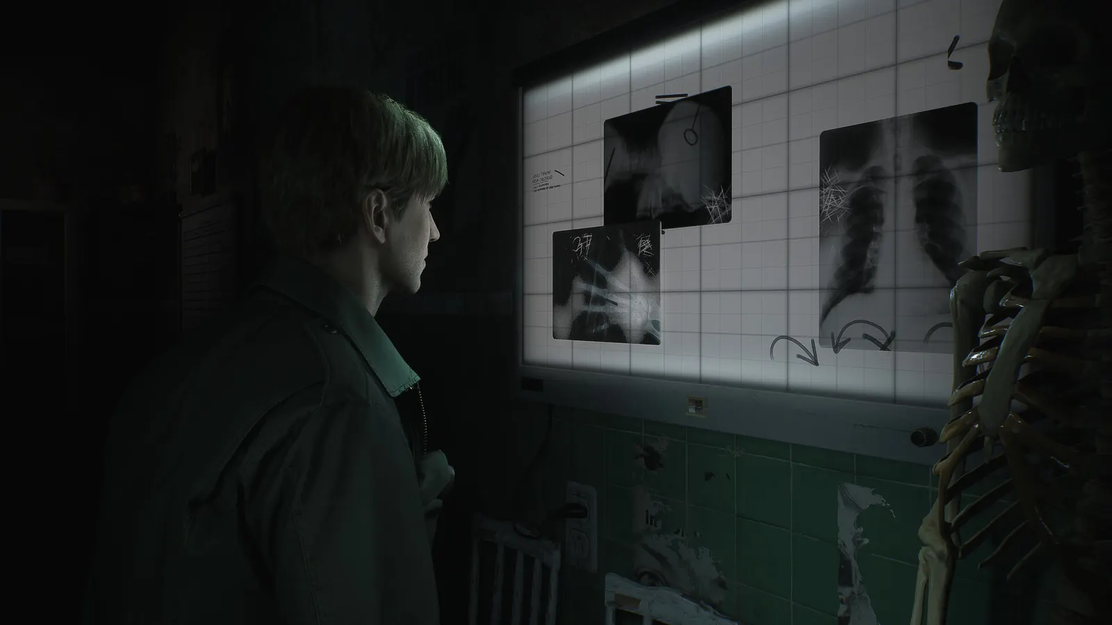 SILENT HILL 2 media 9